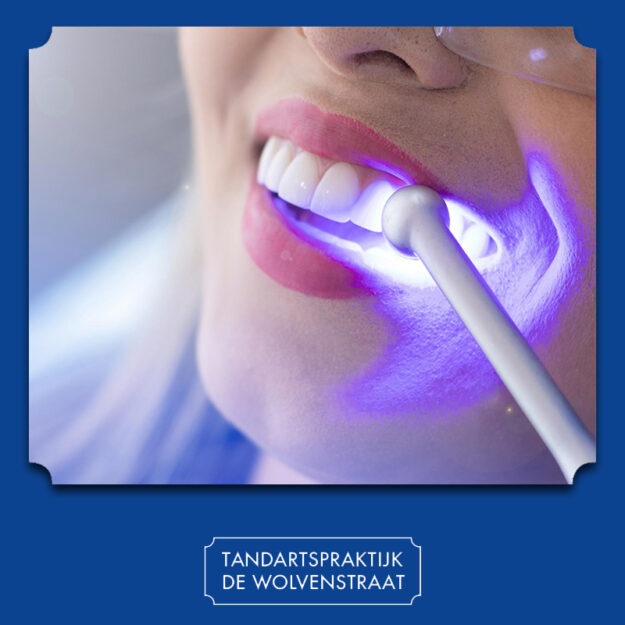 Een blauw licht tand behandeling als cadeau idee.
